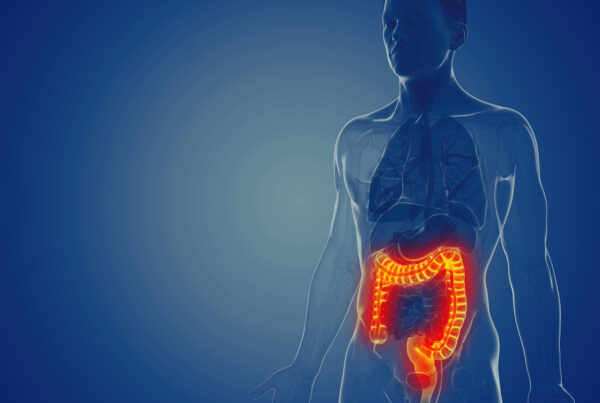 zdjęcie główne_ulcerative colitis