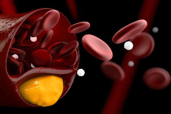 zdjęcie główne_idealny cholesterol