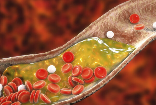 zdjęcie główne_za niski cholesterol