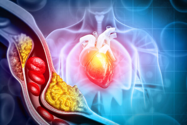 zdjęcie główne_kontrowersje wokół cholesterolu i choroby wieńcowej