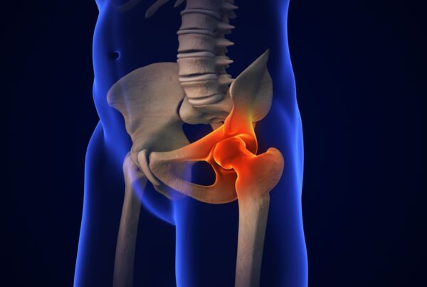 zdjęcie główne_leki na osteoporozę a ryzyko złamań
